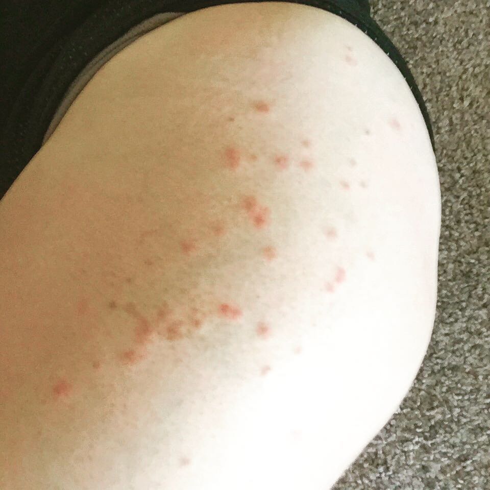 девушки показывают свои растяжки и целлюлит, #ThighReading