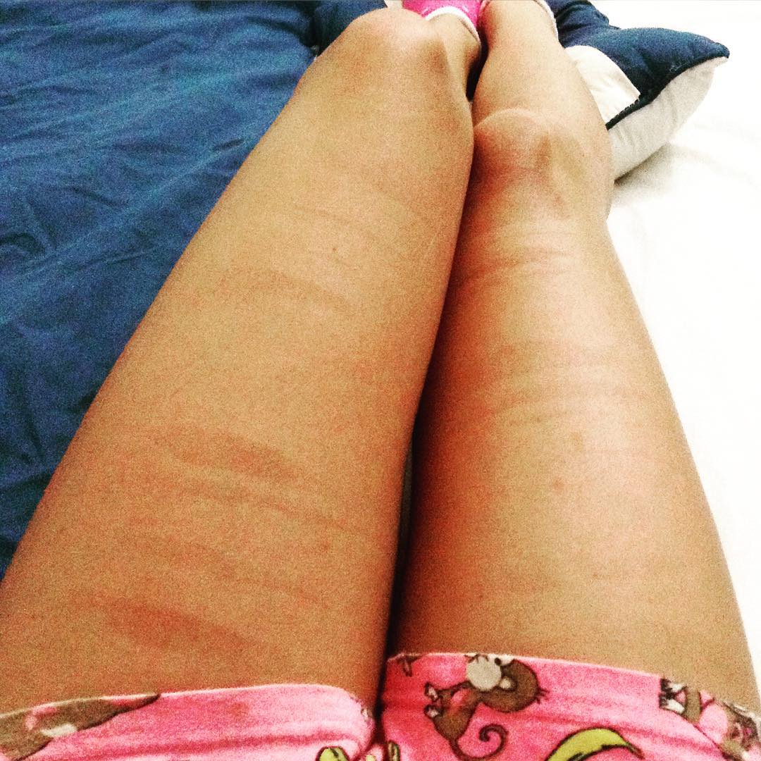 девушки показывают свои растяжки и целлюлит, #ThighReading