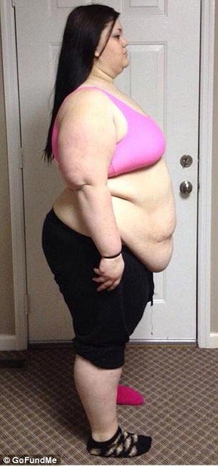 девушка похудела на 95 кг, похудела осталась лишняя кожа, после похудения осталась лишняя кожа, Кейтлин Смит