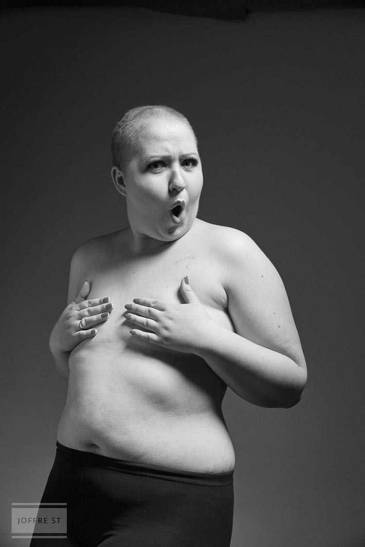 фотосессия после двойной мастэктомии и потери волос, фотосессия после двойной мастэктомии и химиотерапии, Эллисон Снэр, Allison Snare, девушка после двойной мас