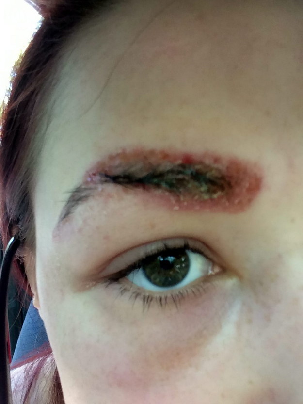 аллергическая реакция на краску для бровей, аллергия на краску для бровей