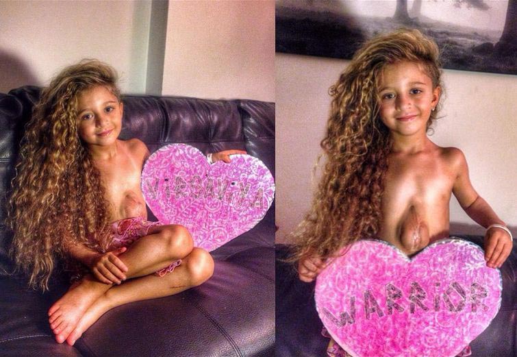 Вирсавия, Вирсавия Борун-Гончарова, Дари Борун, девочка с открытым сердцем, родилась сердце за пределами груди