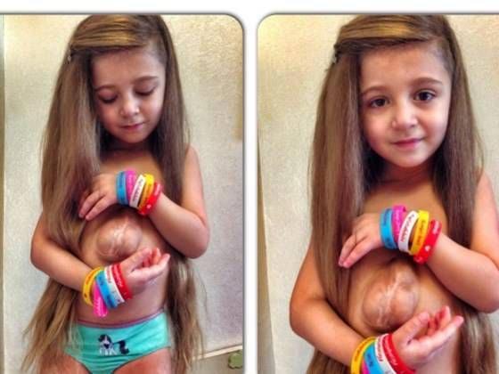 Вирсавия, Вирсавия Борун-Гончарова, Дари Борун, девочка с открытым сердцем, родилась сердце за пределами груди