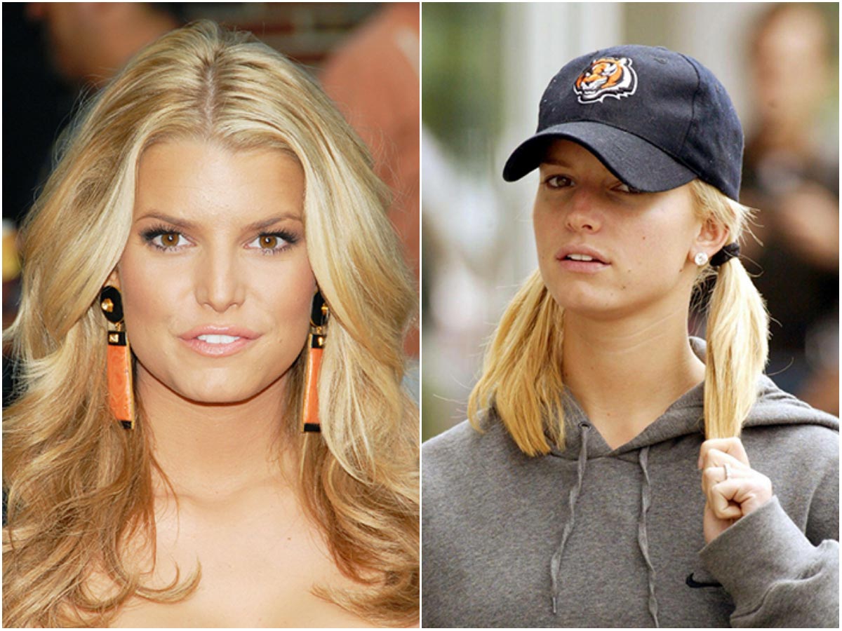 звёзды с проблемной кожей, знаменитости и прыщи