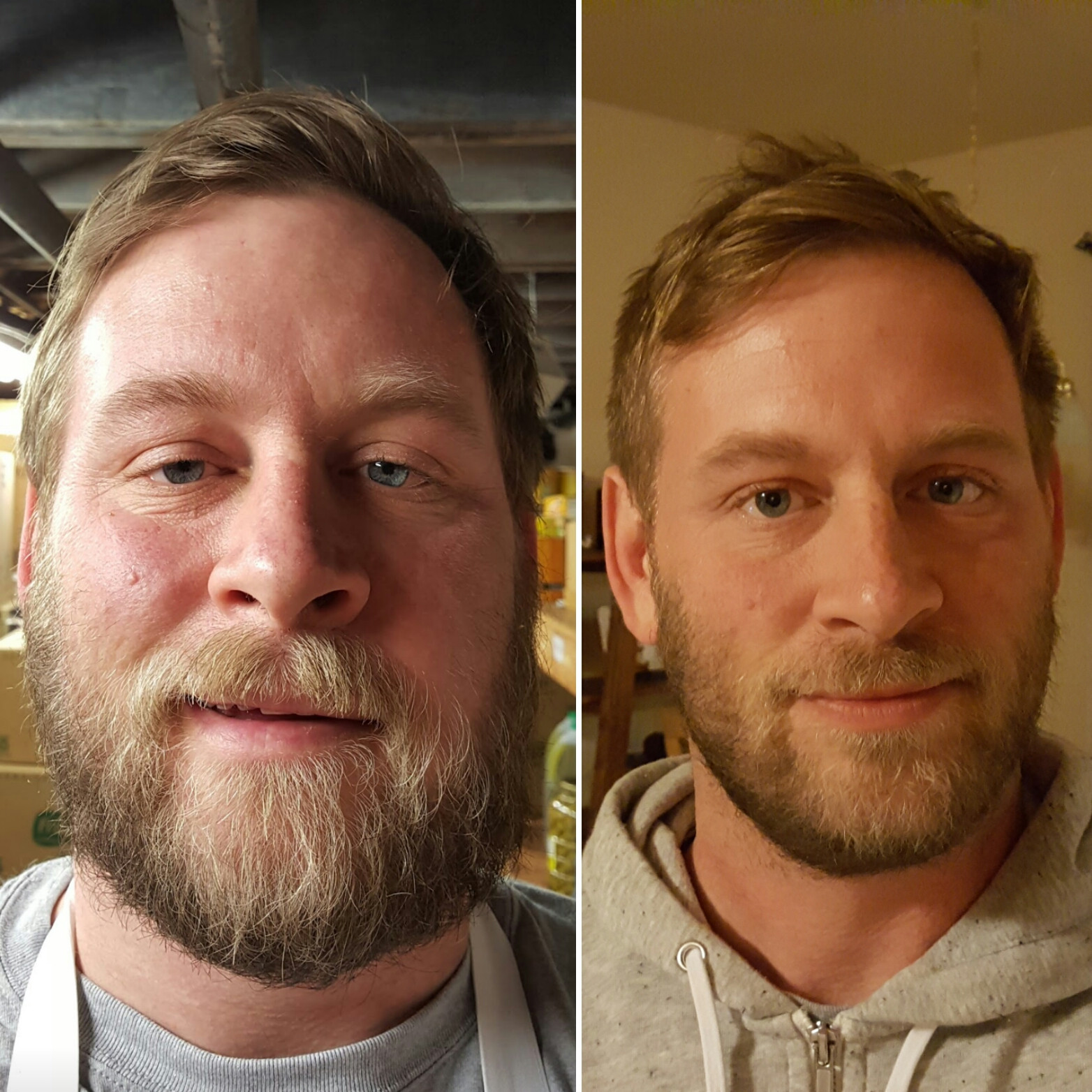 Мужчина после 32. Лицо алкоголика до и после.