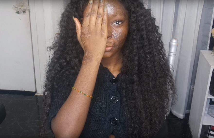 Девушка с ожогами стала визажистом, Шалом Нчом, Shalom Nchom