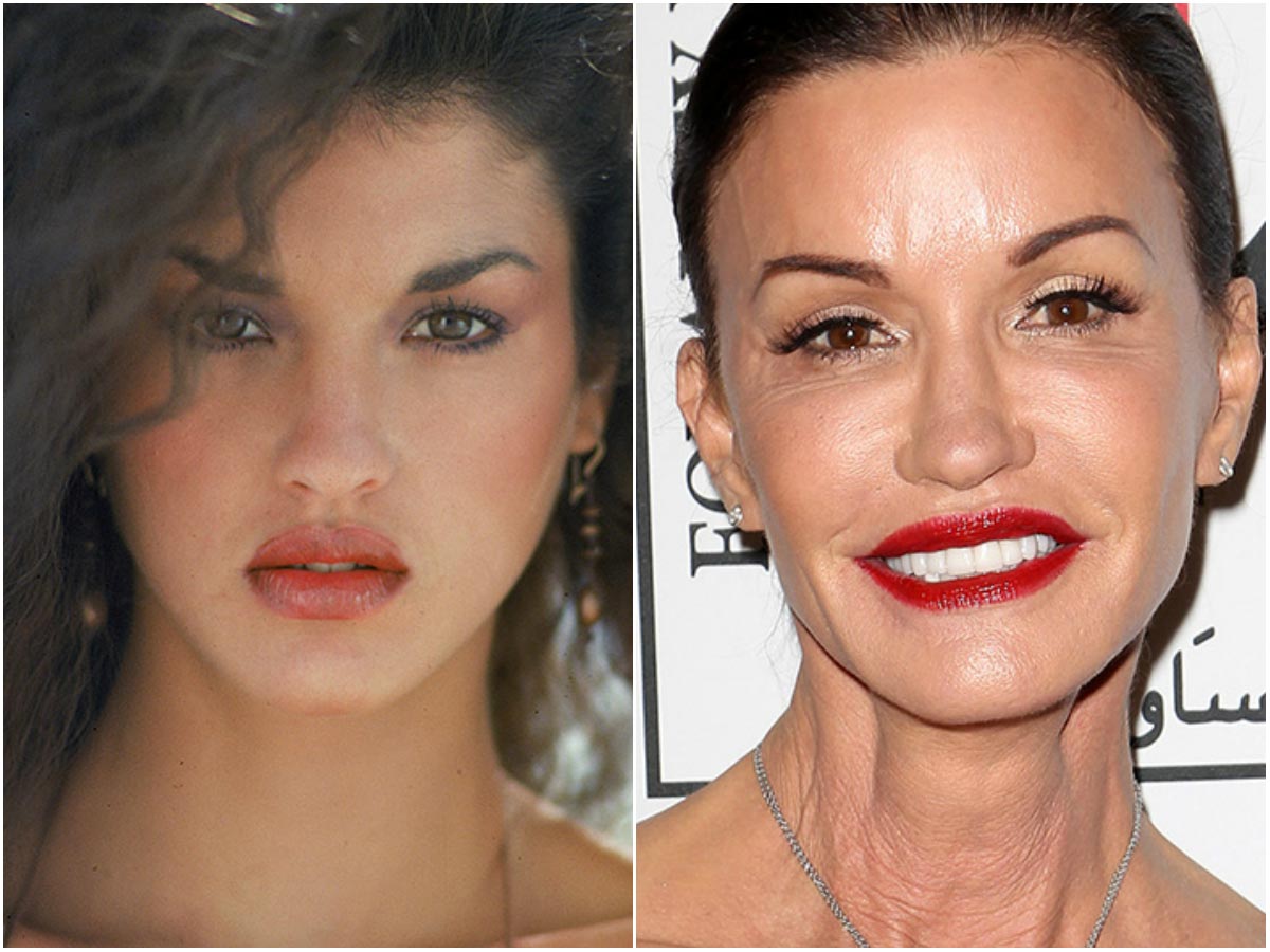 модели с неудачной пластикой, модели испортившие лицо пластикой