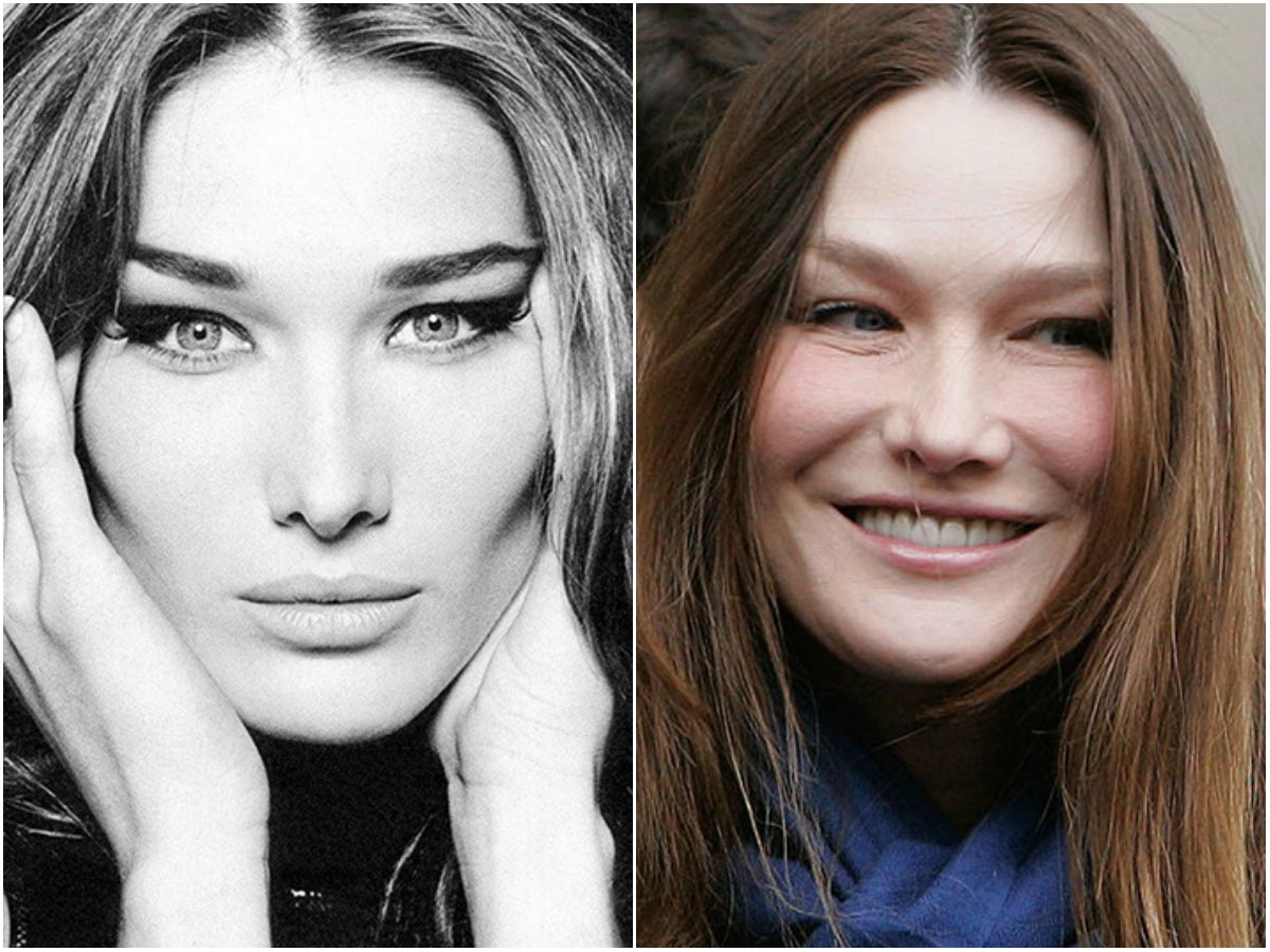 модели с неудачной пластикой, модели испортившие лицо пластикой