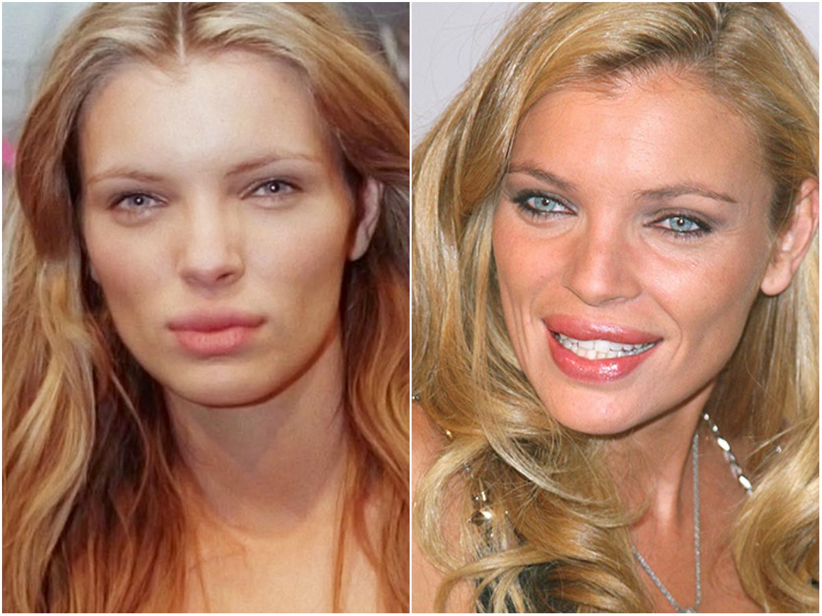 модели с неудачной пластикой, модели испортившие лицо пластикой