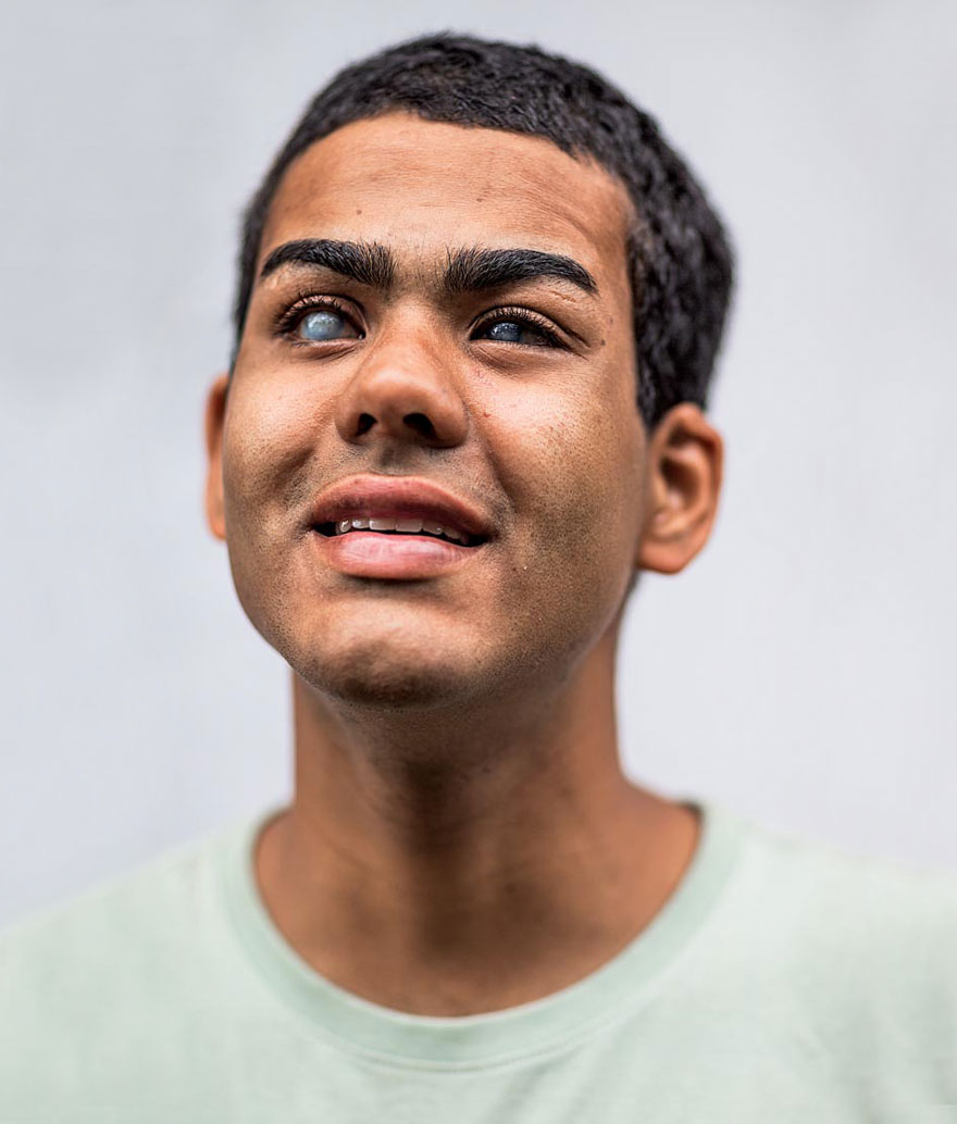 слепой парень стал профессиональным сёрфером, Дерек Рабело, Derek Rabelo