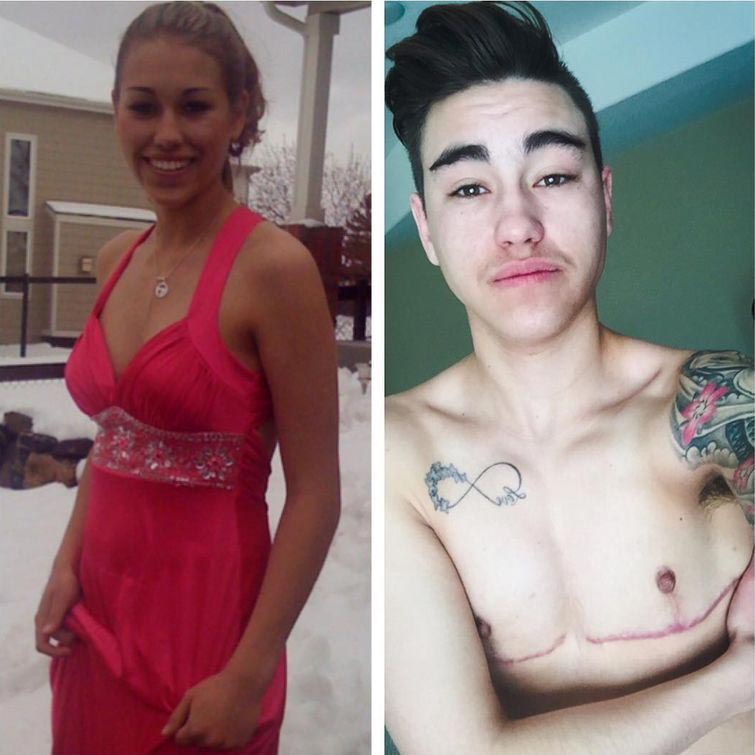 Транс измена муж. ФТМ Джейми 18 +. Смена пола. Трансгендеров до и после. После операции по смене пола.
