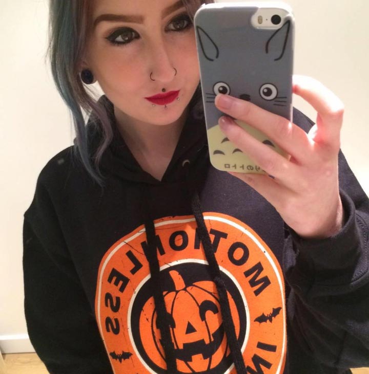 Эйми Роуски, Aimee Rouski,последствия болезни Крона, фото болезнь Крона