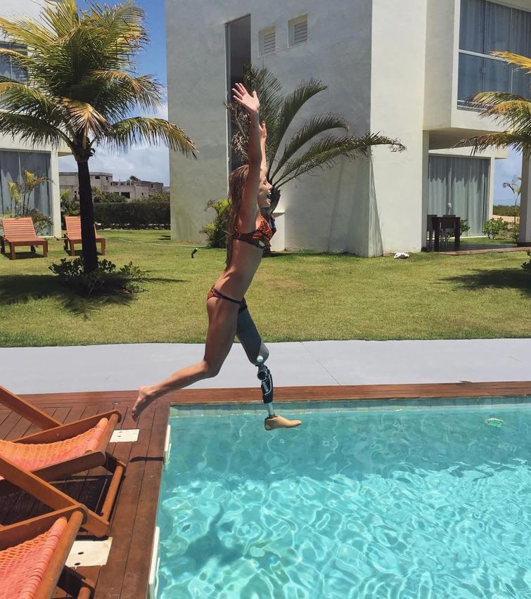 Паола Антонини, Paola Antonini, модель с ампутированной ногой, модель без ноги