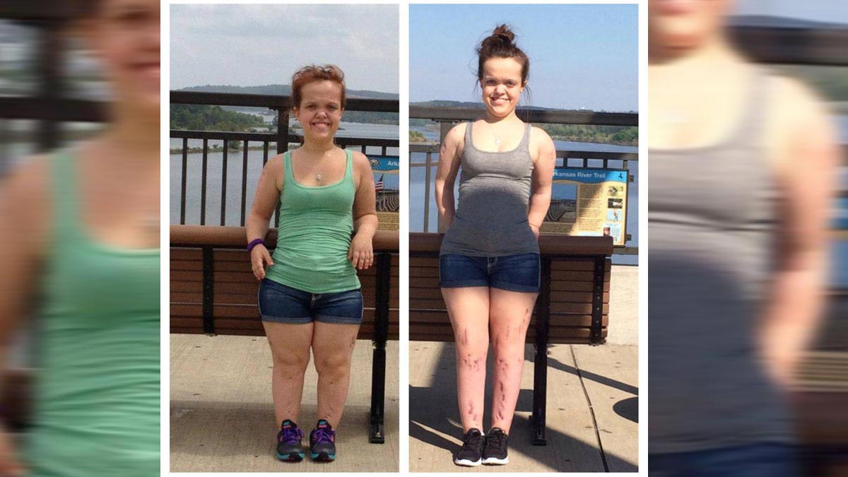 жуткие хирургические операции, пугающие операции