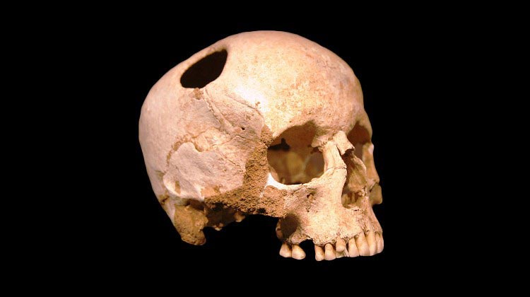 жуткие хирургические операции, пугающие операции