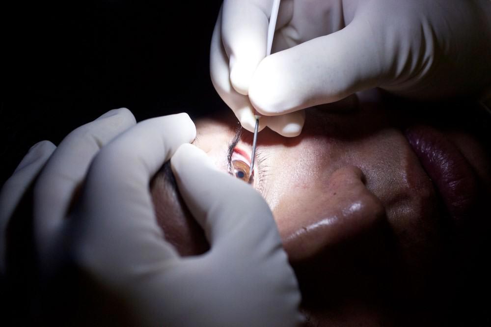 жуткие хирургические операции, пугающие операции