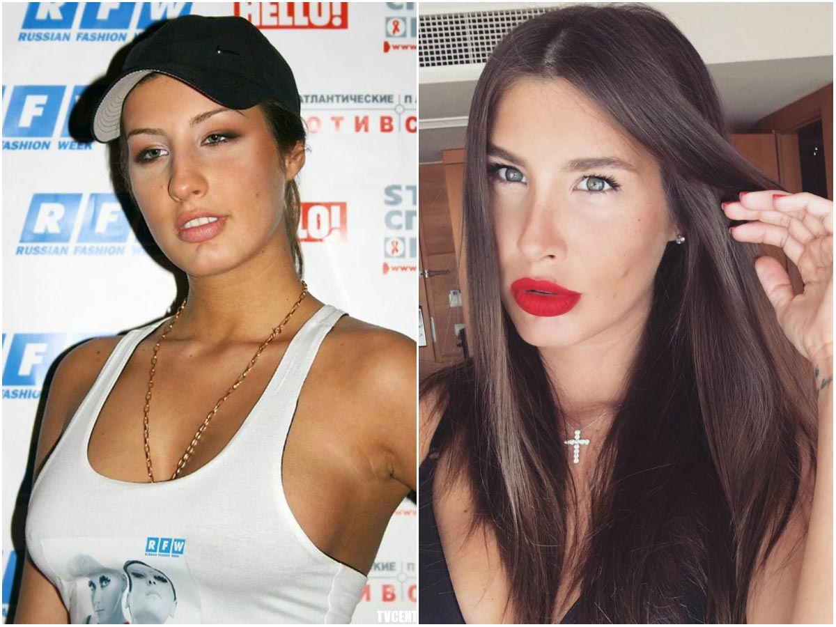 10 звезд, которым пластические операции пошли только на пользу пластические операции, звёзды до и после пластики