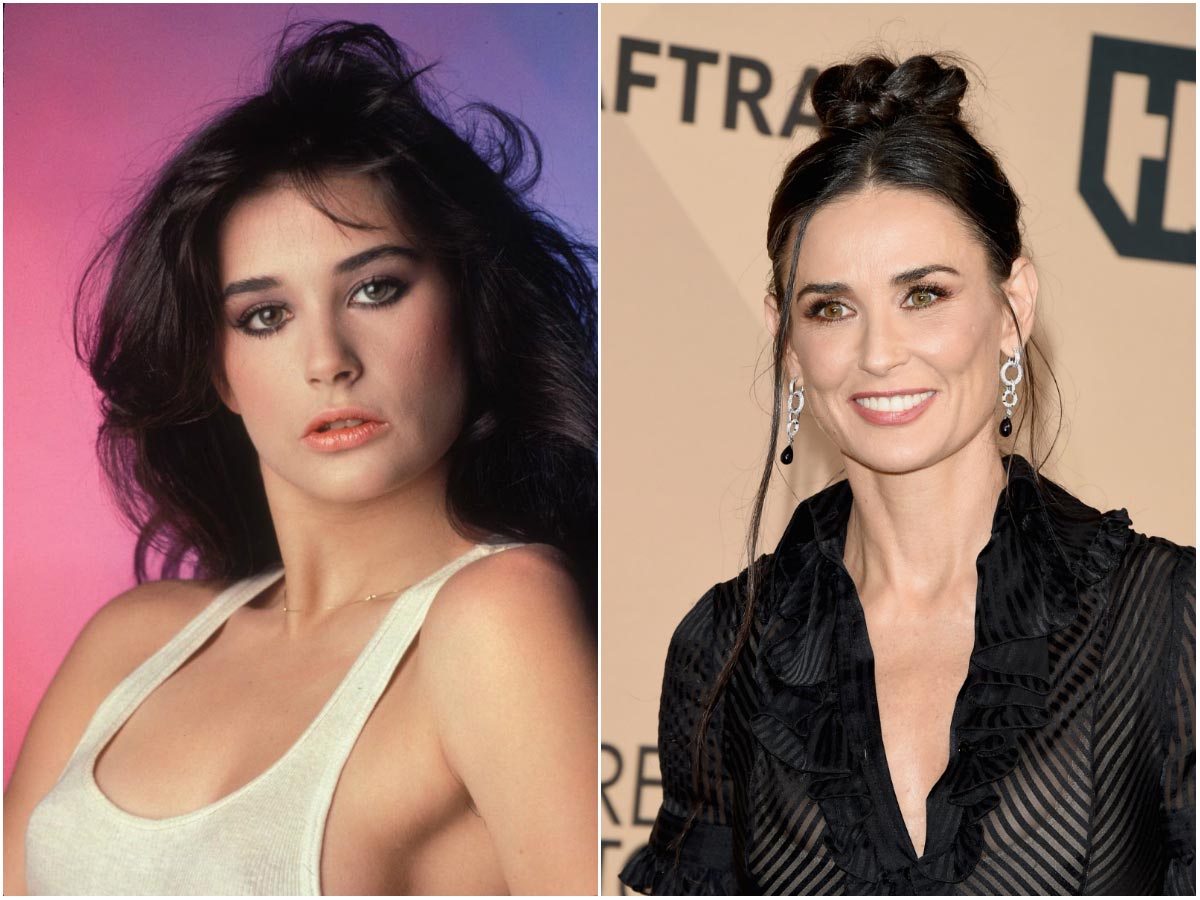 10 звезд, которым пластические операции пошли только на пользу пластические операции, звёзды до и после пластики