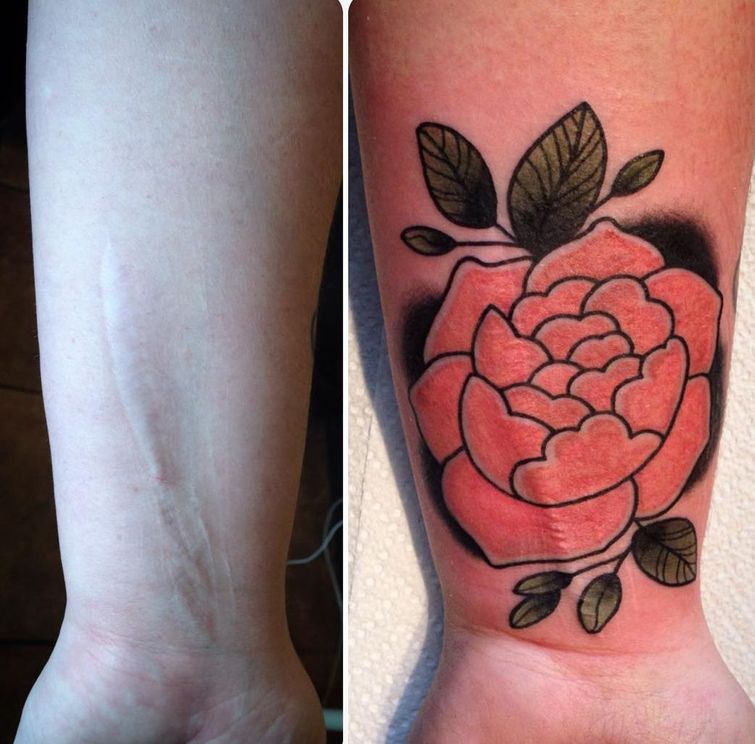 Татуировщик бесплатно перекрывает шрамы жертвам насилия, Брайан Финн, Brian Finn