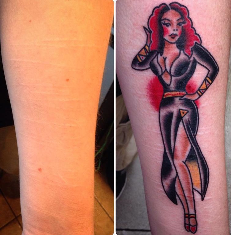 Татуировщик бесплатно перекрывает шрамы жертвам насилия, Брайан Финн, Brian Finn