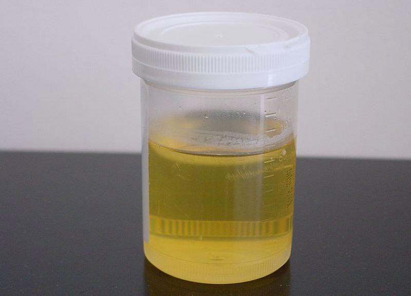 пугающие медицинские процедуры прошлого, операции средневековья