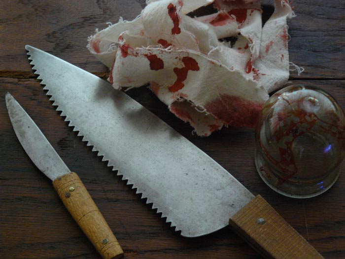 пугающие медицинские процедуры прошлого, операции средневековья