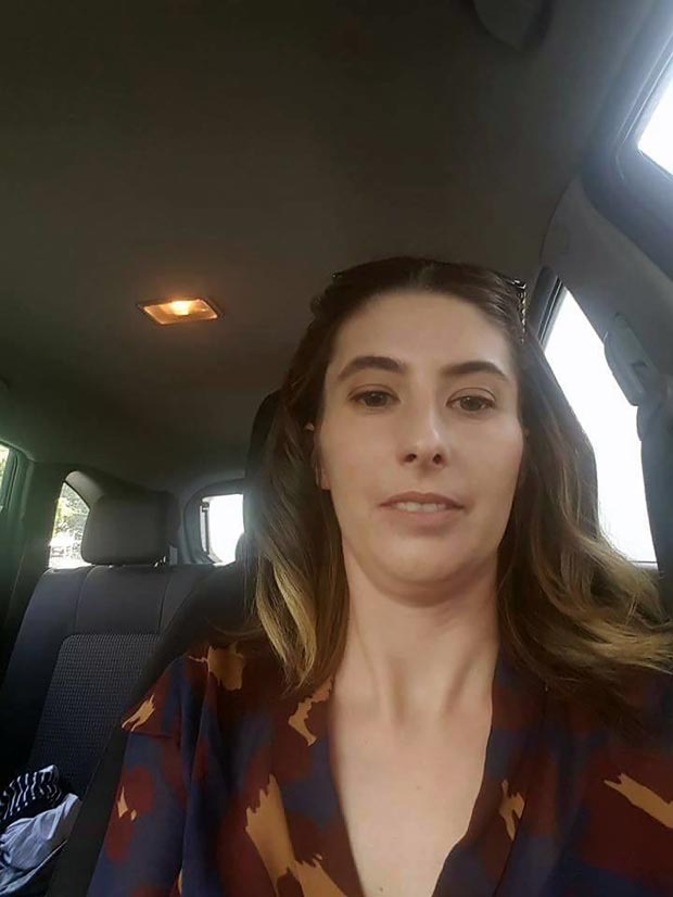 удалили 20 зубов, очень кривые зубы, кривые зубы до и после лечения