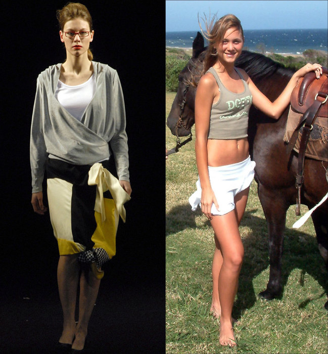 Смертельная худоба: 10 историй о знаменитых женщинах, умерших от анорексии умершие от анорексии, истории об анорексии