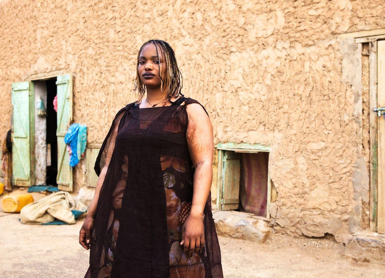 факты об ожирении, всё об ожирении