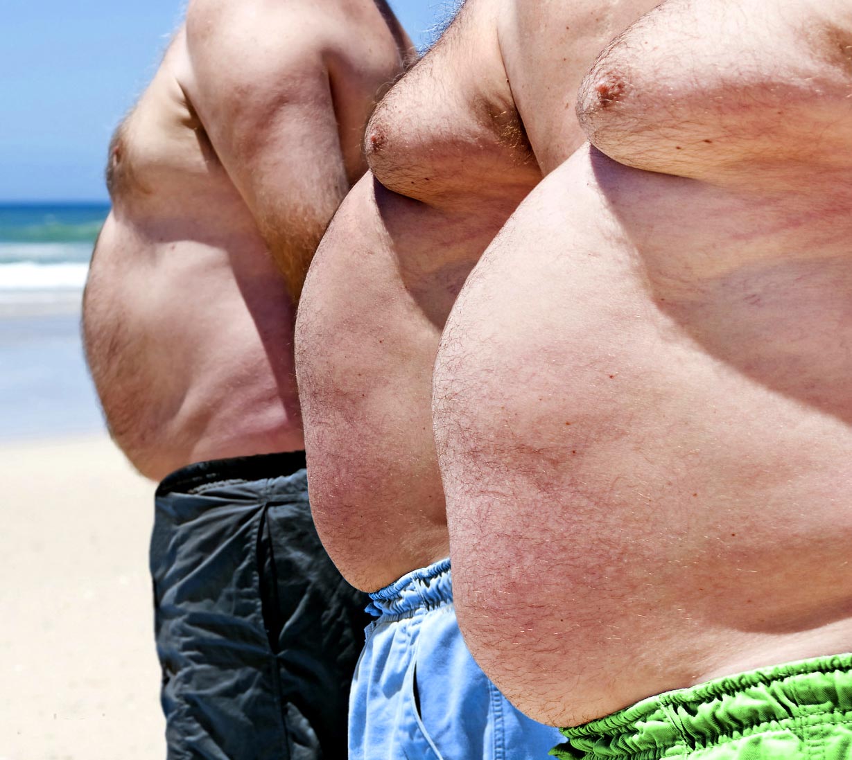 факты об ожирении, всё об ожирении