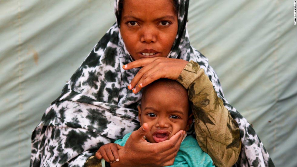 факты об ожирении, всё об ожирении