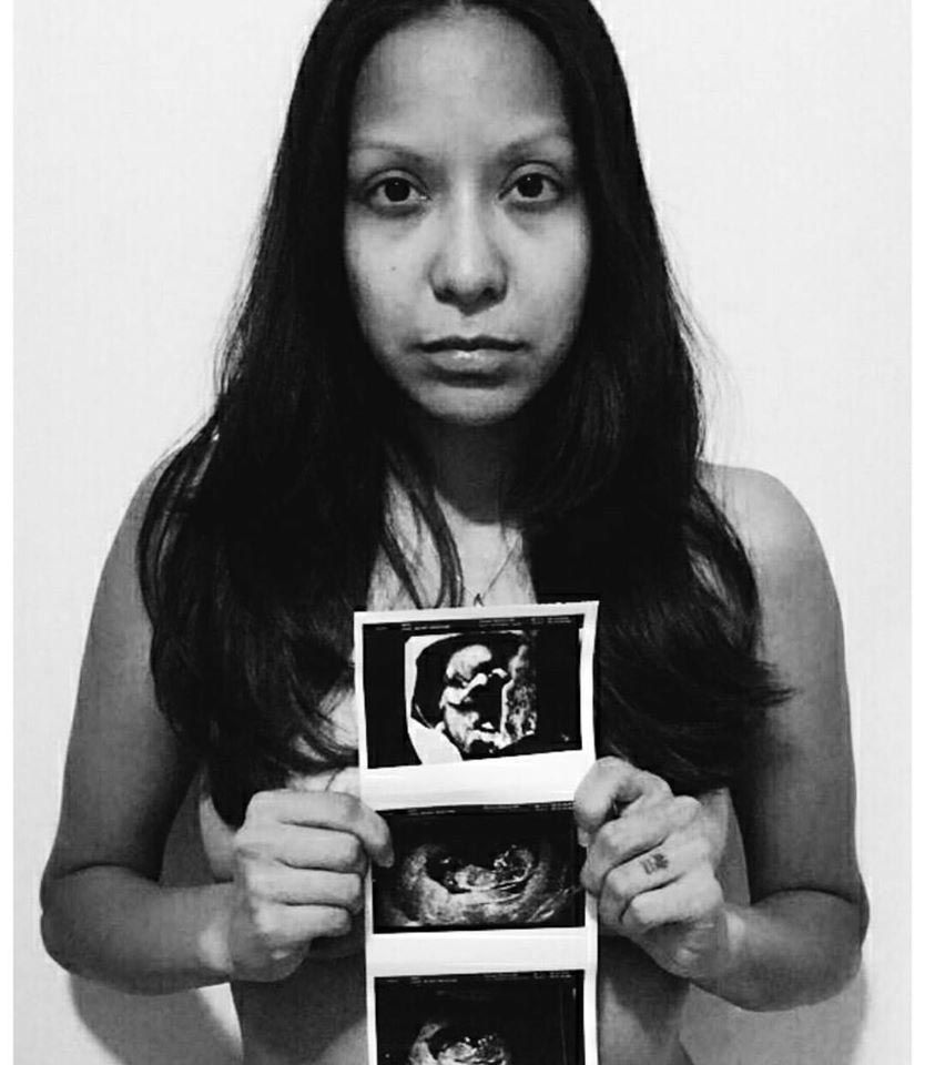 Эта мама нашла способ превратить трагедию в нечто хорошее, после того как её ребёнок родился мёртвым превратила трагедию в нечто хорошее, пожертвовала 60 литров грудного молока, жертвовала грудное молоко ребенок родился мертвым