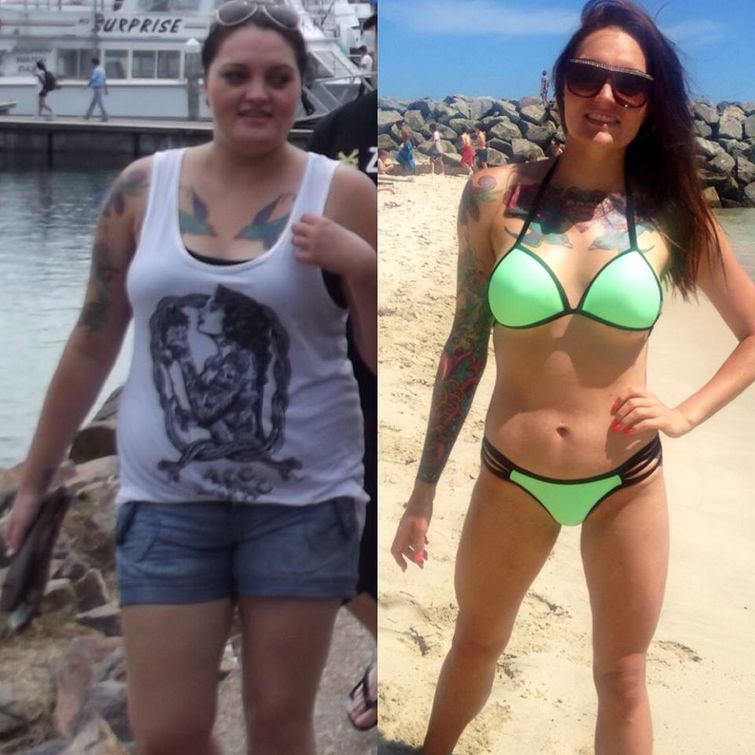 жизнь с синдромом поликистозных яичников, девушка бреет лицо из-за синдрома, девушке приходится брить лицо