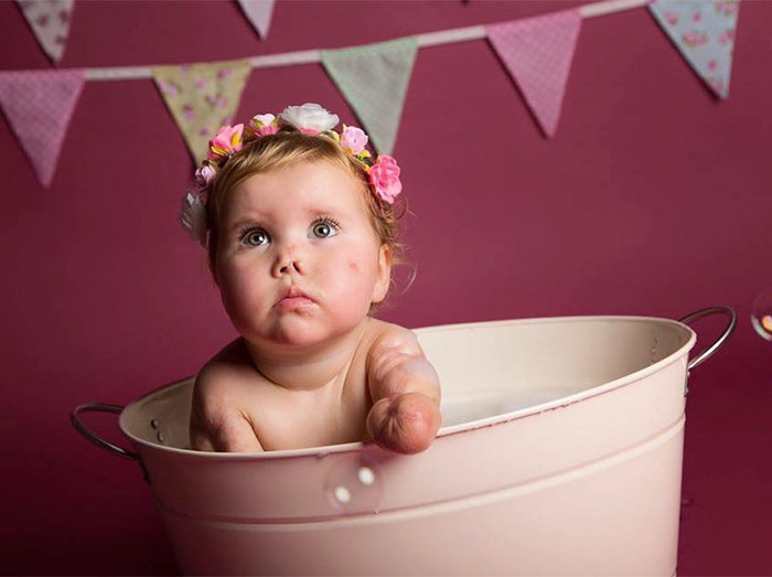 2-летняя девочка без рук и ног получила куклу-инвалида, кукла-ампутант, кукла-инвалид