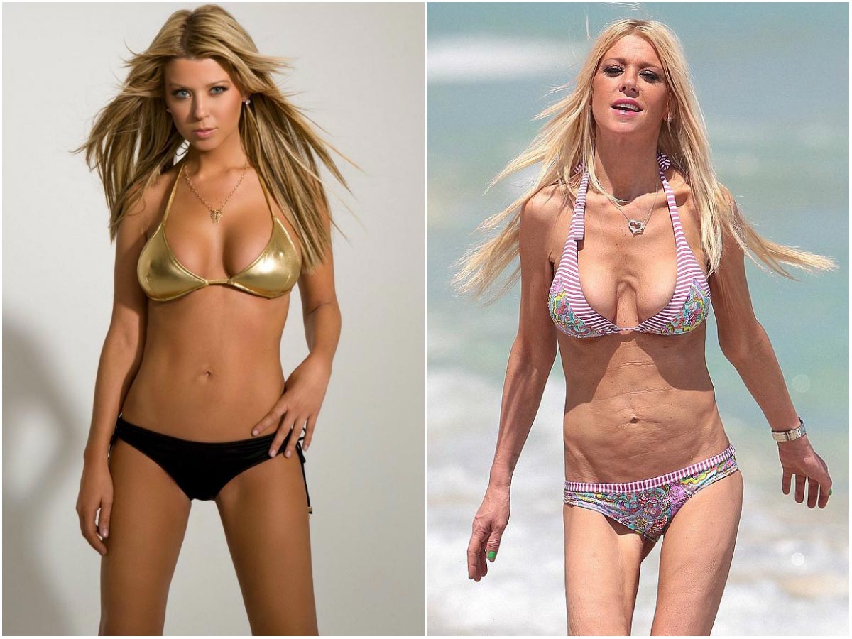 звёзды испортившие свою внешность, звёзды которые раньше выглядели лучше