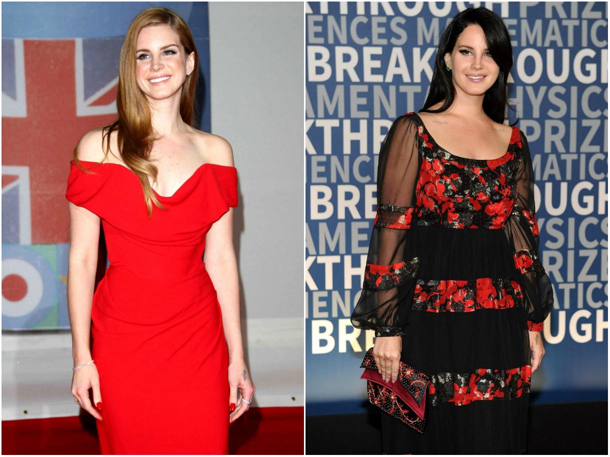 звёзды испортившие свою внешность, звёзды которые раньше выглядели лучше