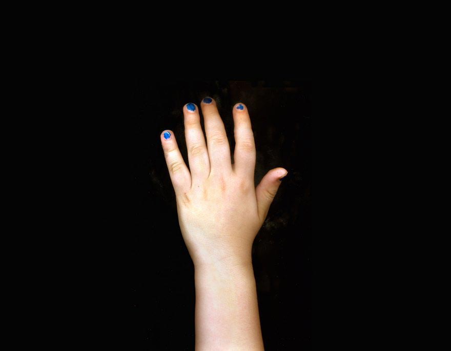 привычки сына аутиста, привычки мальчика аутиста, ECHOLILIA, Тимоти Арчибальд, Thimothy Archibald