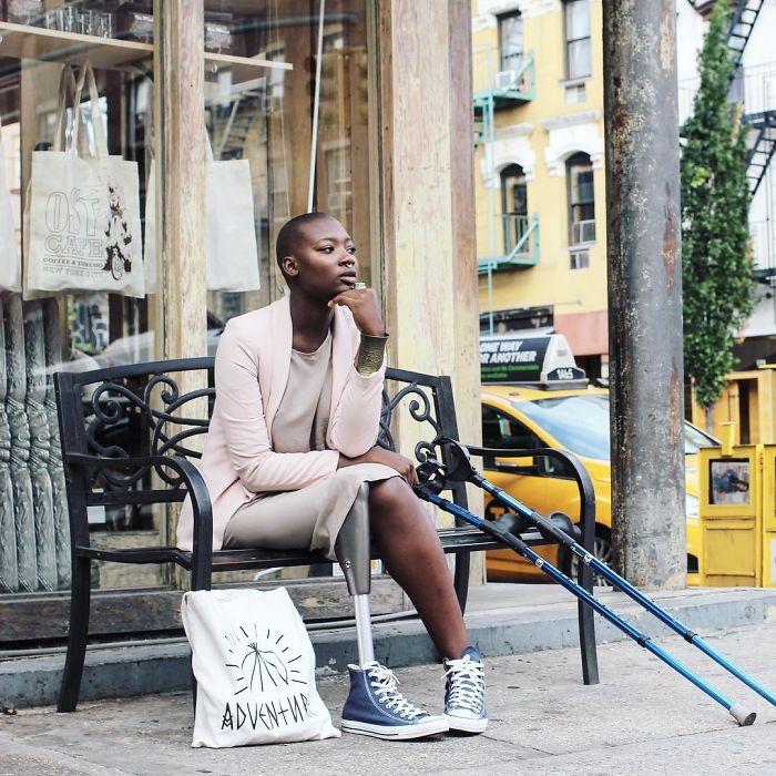 Девушке с ампутированной ногой оставалось жить всего 3 недели, но она победила болезнь и стала модным блогером Девушке с ампутированной ногой оставалось жить всего 3 недели, девушка без ноги стала блогером и моделью, Мама Какс, Mama Cax