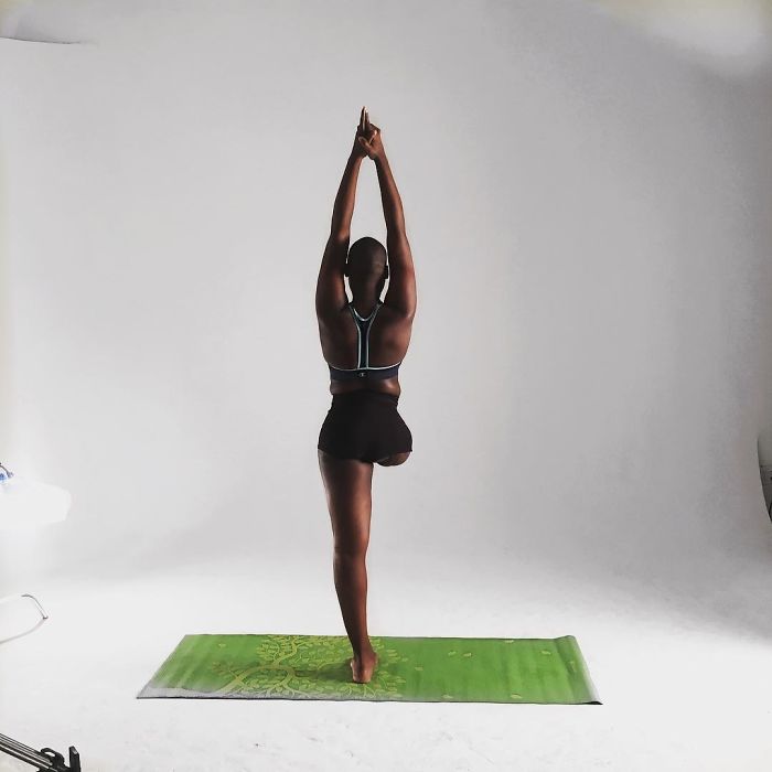 Девушке с ампутированной ногой оставалось жить всего 3 недели, но она победила болезнь и стала модным блогером Девушке с ампутированной ногой оставалось жить всего 3 недели, девушка без ноги стала блогером и моделью, Мама Какс, Mama Cax