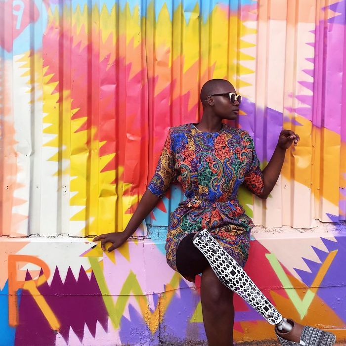 Девушке с ампутированной ногой оставалось жить всего 3 недели, но она победила болезнь и стала модным блогером Девушке с ампутированной ногой оставалось жить всего 3 недели, девушка без ноги стала блогером и моделью, Мама Какс, Mama Cax