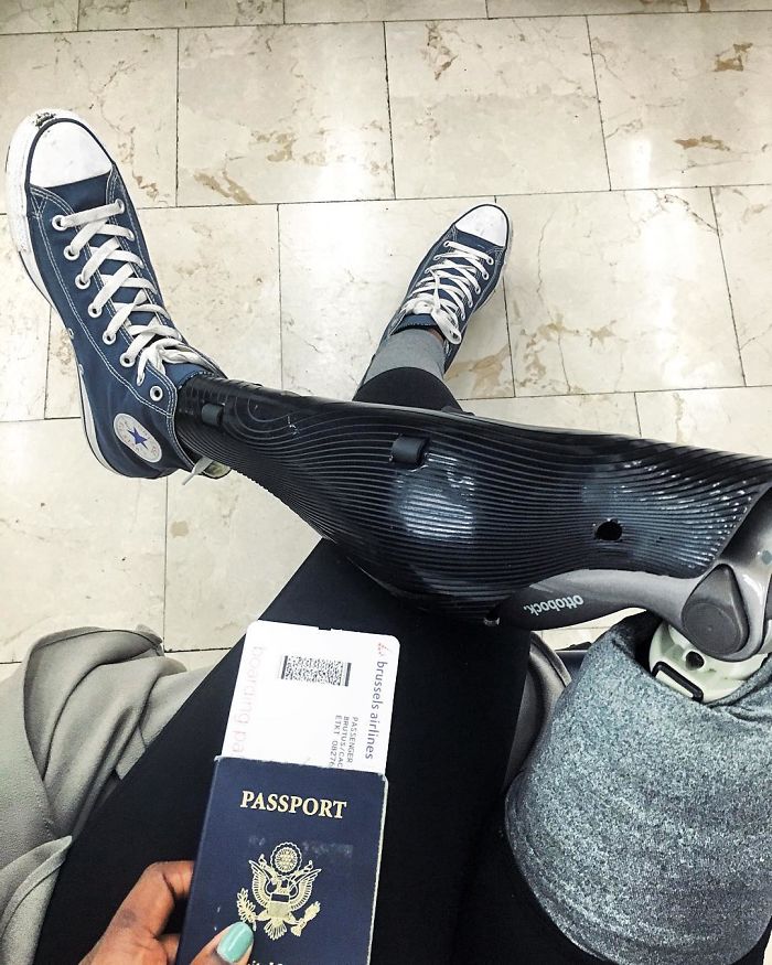 Девушке с ампутированной ногой оставалось жить всего 3 недели, но она победила болезнь и стала модным блогером Девушке с ампутированной ногой оставалось жить всего 3 недели, девушка без ноги стала блогером и моделью, Мама Какс, Mama Cax