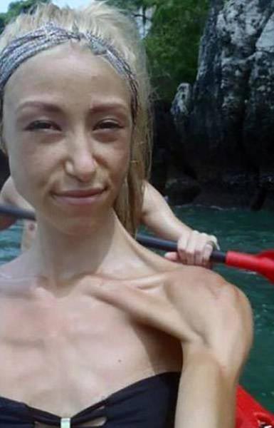 Девушка решила бороться с анорексией при помощи тяжёлой атлетики и её результат вас удивит победила анорексию, Софи Гажник, Sophie Gajnik, до и после анорексии, поборола анорексию тяжёлая атлетика