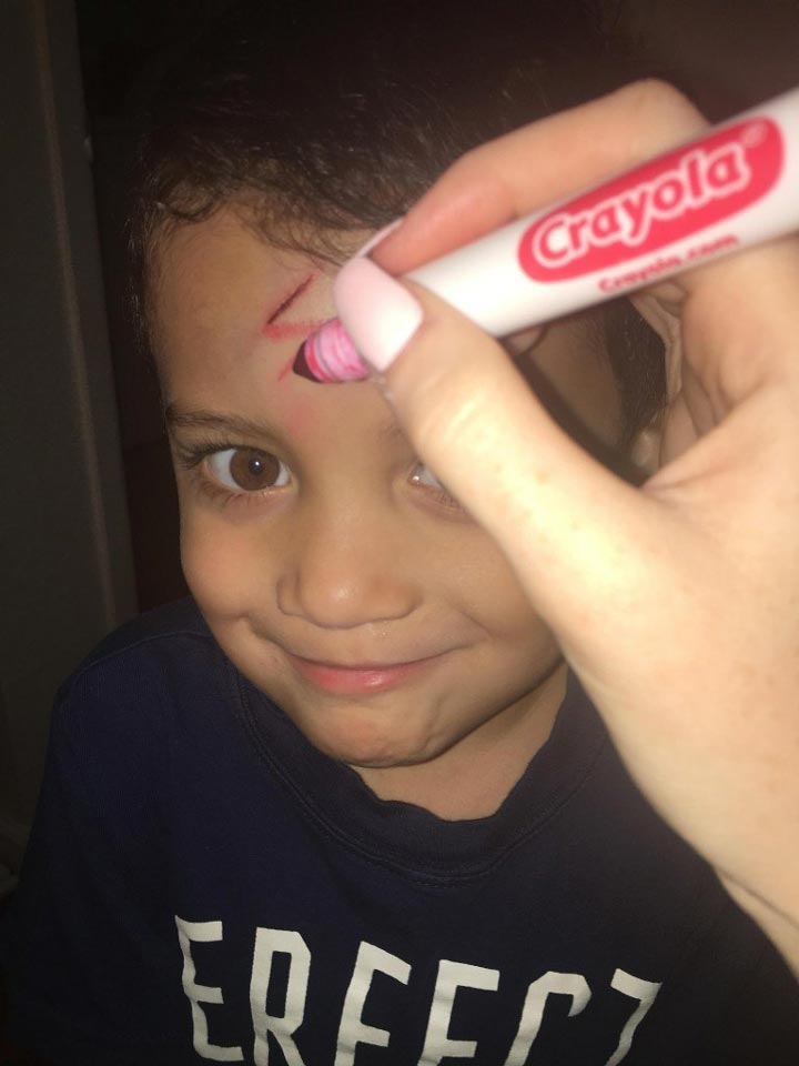 исправила ссадину сына, исправила ссадину на шрам Гарри Поттера, исправила ссадину знак Гарри Поттера, исправила ссадину сын гордился