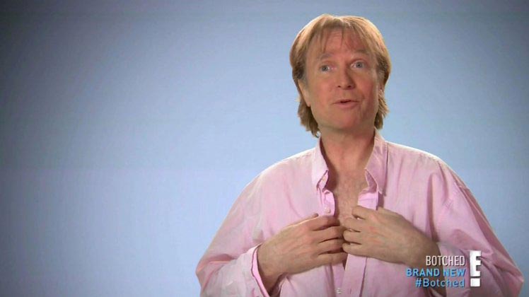 Брайан Зембик, Brian Zembic, мужчина силиконовая грудь на спор, установил на спор грудные импланты, установил в грудь импланты за 100000 долларов