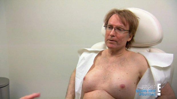 Брайан Зембик, Brian Zembic, мужчина силиконовая грудь на спор, установил на спор грудные импланты, установил в грудь импланты за 100000 долларов