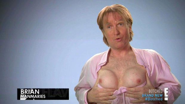 Брайан Зембик, Brian Zembic, мужчина силиконовая грудь на спор, установил на спор грудные импланты, установил в грудь импланты за 100000 долларов