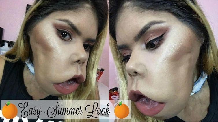 Маримар Кироа — 21 летний бьюти-блогер с огромной опухолью на лице Маримар Кироа, Marimar Quiroa, бьюти блогер с опухолью на лице, девушка с огромной опухолью на лице