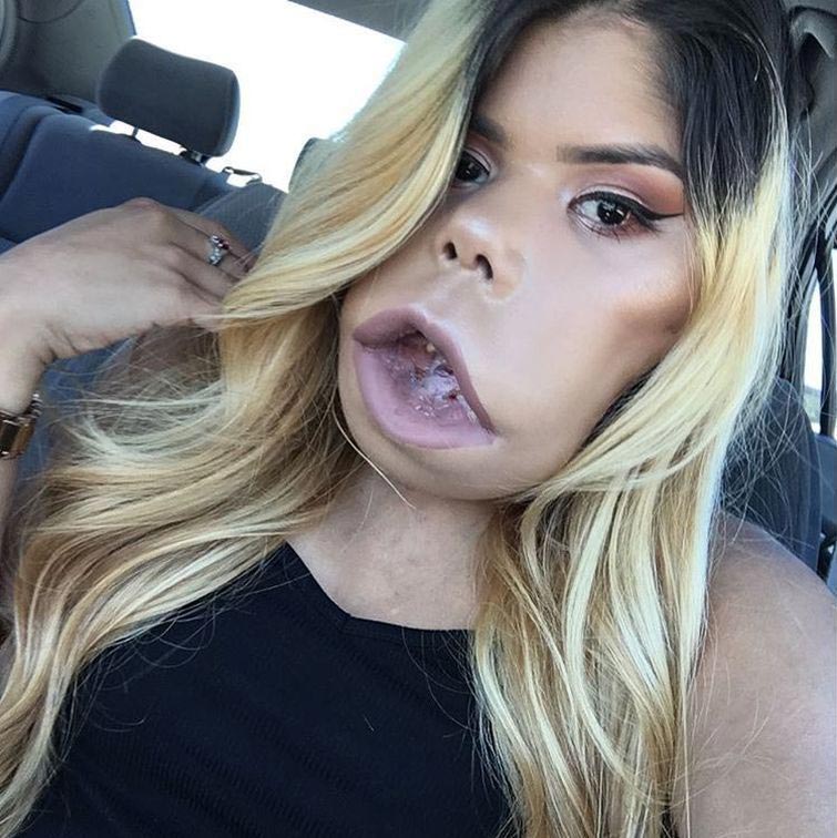 Маримар Кироа — 21 летний бьюти-блогер с огромной опухолью на лице Маримар Кироа, Marimar Quiroa, бьюти блогер с опухолью на лице, девушка с огромной опухолью на лице