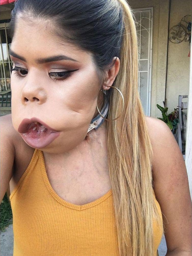 Маримар Кироа — 21 летний бьюти-блогер с огромной опухолью на лице Маримар Кироа, Marimar Quiroa, бьюти блогер с опухолью на лице, девушка с огромной опухолью на лице