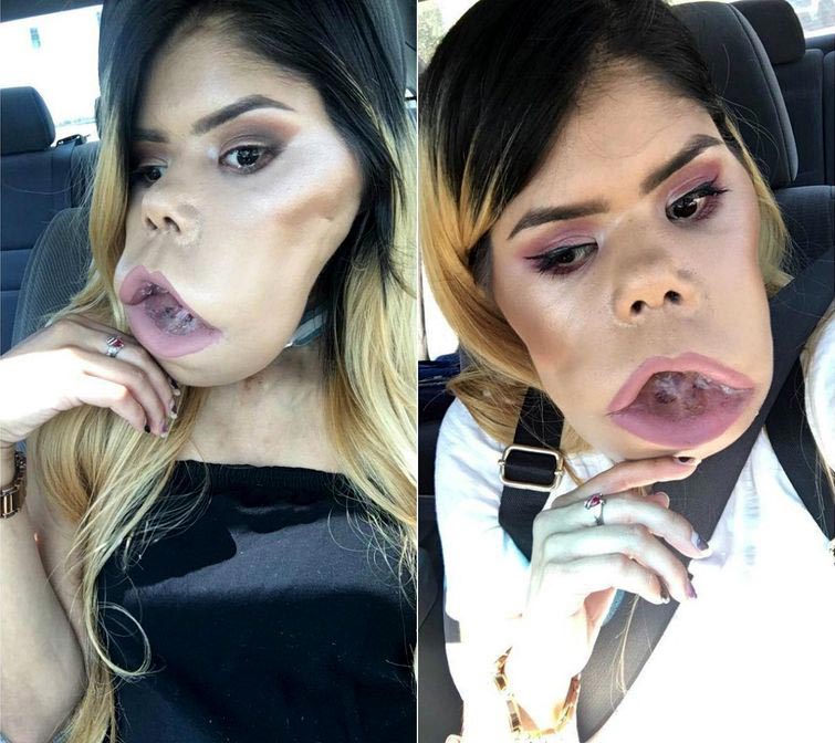 Маримар Кироа — 21 летний бьюти-блогер с огромной опухолью на лице Маримар Кироа, Marimar Quiroa, бьюти блогер с опухолью на лице, девушка с огромной опухолью на лице